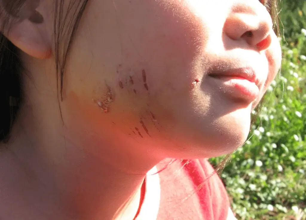 Dog Bites in Arizona – When is Animal Owner Responsible For Injuries?