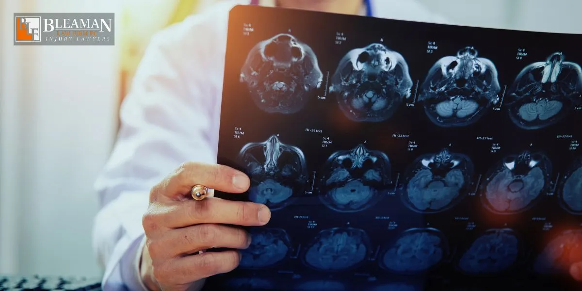 Best Phoenix Traumatic Brain Injury Lawyer Phoenix Traumatic Brain Injury Lawyer